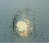 Figure 10 - Pothole