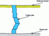 Figure 57 - Defects on cased piles