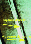 Figure 3 - Total absence of grouting and liner deformation (Crédit LCPC)