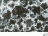 Figure 16 - Growth matrix made of biodegradable polymer [1].