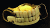 Figure 20 - George Washington's dentures [97]