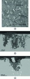 Figure 4 - (a) Macroscopic appearance of pitting on an aluminum alloy after corrosion in a salt spray chamber. Metallographic sections of pitting in a 2214 T6 alloy after 200 h of salt spray testing, (b) white appearance pitting ("dome" of Al(OH)3), (c) black appearance pitting (hole or cavity).