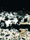 Figure 36 - Desquamation of a limestone surface (polarized optical microscopy)