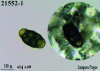 Figure 50 - Cyanobacteria inside a limestone facing (Source Lerm)
