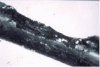 Figure 30 - Reinforcement with localized corrosion