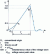 Figure 6 - Lightning strike to the forehead