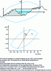 Figure 36 - Dynamic field/wall interaction and comparison with an experimental cycle performed at a frequency of 100 Hz on a FeSi HiB sample