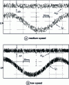 Figure 13 - Allure of is 1 and of 