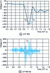 Figure 24 - Response of the cable transfer model (Matlab /Simulink)