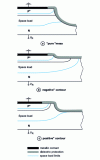 Figure 18 - Examples of chemically etched terminations