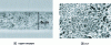 Figure 9 - New transfer technologies