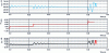 Figure 16 - LC mixed link response to power steps – Highlighting the risk of operating point instability