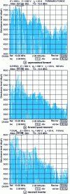 Figure 1 - Comparison of conducted disturbance spectra of 3 kW DC-DC converters operating at 100 kHz