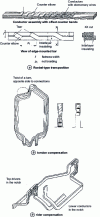 Figure 2 - Transpositions or compensations of elementary wires