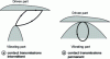 Figure 20 - Vibrating part contact point trajectories used in resonant motors