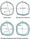 Figure 17 - Galleries