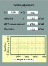 Figure 13 - Checking participation in secondary voltage control