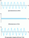 Figure 14 - Influence of a 175 Hz interharmonic signal on the voltage waveform