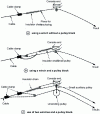 Figure 15 - Tower-mounted cable anchors