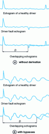 Figure 1 - Classic method: characteristic echograms