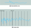 Figure 11 - Comparison method 1re form: looped echograms