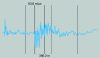 Figure 24 - Differential comparison method: echogram screen shot with loop