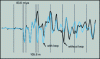 Figure 28 - Differential comparison method: echograms of networks with leads