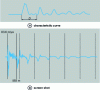 Figure 8 - Direct voltage method: echograms