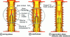 Figure 7 - Thermal blow-out switch chamber