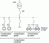 Figure 36 - The four types of low-voltage compensation