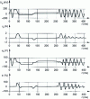 Figure 16 - Example of sudden power-up, after line discharge and before circuit demagnetization. Instantaneous error due to reclosing under saturated conditions