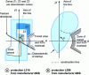 Figure 19 - Start-up characteristics adapted to avoid the transit zone