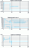 Figure 38 - Behavior under belt breakage