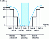 Figure 3 - Example of an attenuation filter band-pass template