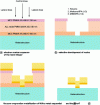 Figure 15 - Schematic diagrams of the technological realization of a T-grid