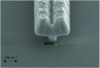 Figure 17 - Cross-section of a T-grid showing a 125 nm grid foot