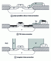 Figure 36 - Local interconnections in polycrystalline silicon, TiN and W