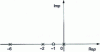 Figure 55 - Poles (– 6, – 2 and 0) and zero (– 1) of 