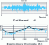 Figure 4 - 125 ms extract of the /ch/ sound (a) and spectra obtained by DFT and AR-15 modelling (b) over a 30 ms block.