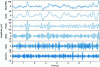 Figure 6 - Typical EEG signals (Bajaj, Wavelet Theory 2020 (open access)) [48]