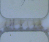 Figure 19 - Image of dendrites between two sintered silver joints [6].