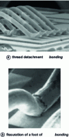 Figure 21 - Wiring wire failure modes during thermal cycling: (a) delamination of wiring wires and (b) cracking of a wiring wire foot [28] [36].