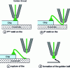 Figure 7 - Ball bonding wiring sequence