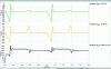 Figure 26 - Output voltage sensitivities