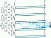 Figure 30 - Electron multiplication in the microchannel wafer