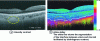 Figure 17 - Polarized light OCT images of the retina: intensity contrast and phase delay (from Opt. Express 20, 3353 (2012))