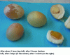 Figure 2 - Anti-cent eggs in various stages of maceration in vinegar