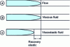 Figure 8 - Elastic recovery of a viscoelastic fluid when flow stops in a pipeline