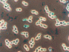 Figure 13 - Saccharomyces cerevisiae budding. Cells are ellipsoidal and well individualized. (Phase contrast microscopy × 400)