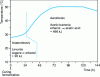 Figure 5 - Fermentation stages linked to aeration: theoretical evolution of temperature (from [1])